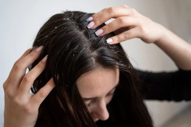 Dry Scalp The Main Reason for Itching