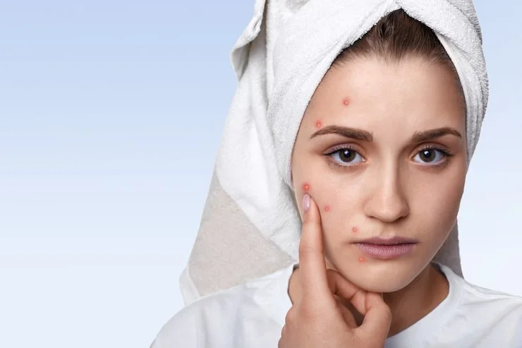 What Is This Skin Problem Actually